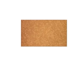 Human Peripheral Blood Monocytes: HPBM