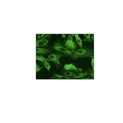 Human Renal Proximal Tubular Epithelial Cells: HRPTEpC, fetal