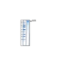 Epidermal Growth Factor Receptor human