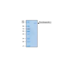 Thrombospondin-1 human