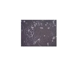 MCF-7/S0.5 Human Breast Cancer Cell Line