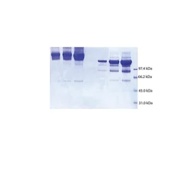Alpha 2 Macroglobulin from human plasma