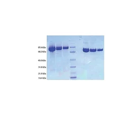 Plasminogen from human plasma